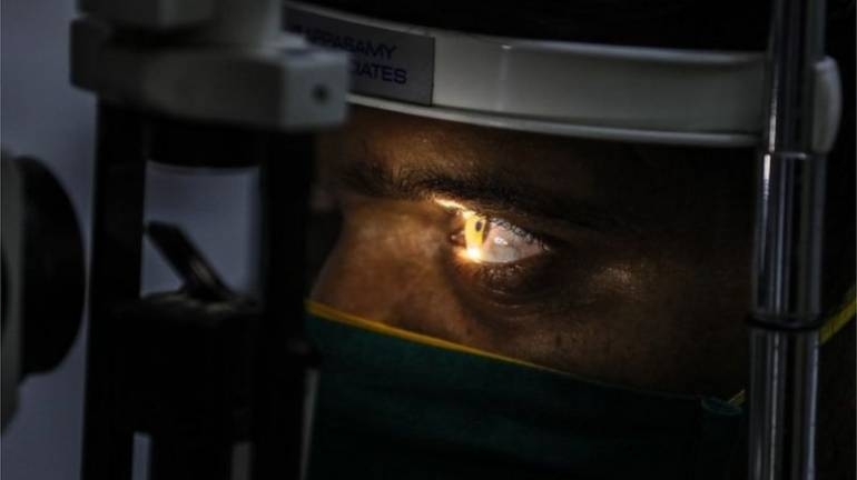 Hongo negro en India: extirpan ojos a pacientes con Covid para salvarlos