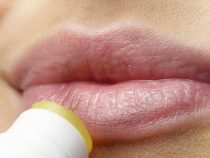 Las llagas o “fuegos” recurrentes podrían indicar una patología neoplásica