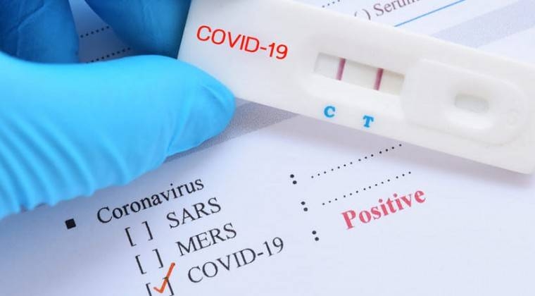 Nuevo récord de 135 fallecidos por COVID-19 en un solo día, con más de 2.100 nuevos casos