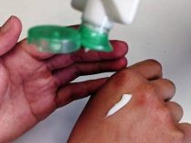 Cómo cuidar la piel en épocas de frío Cómo cuidar la piel en épocas de frío