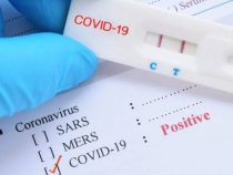 Tendencia se mantiene estable: reportan 879 casos de COVID-19 y 52 nuevos fallecidos