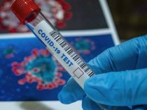 Brasil ya contabiliza 110 casos de la variante Delta del COVID-19