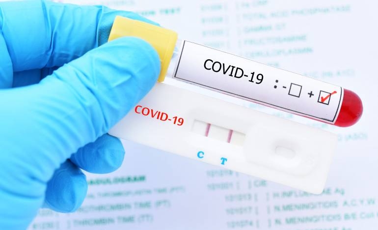 Argentina reporta 9.803 nuevos casos de covid-19 y 89 muertes