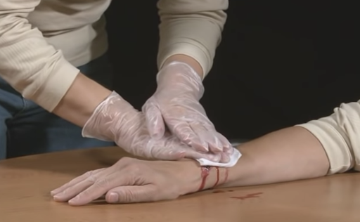 Crean un pegamento de sellado rápido de heridas inspirado en los percebes