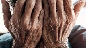 La demencia, una enfermedad olvidada pero de plena actualidad